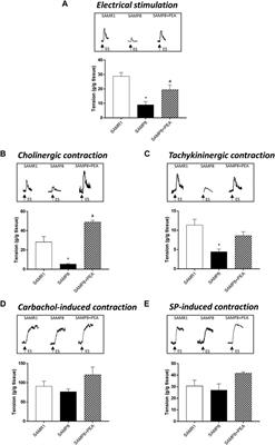 Palmitoylethanolamide Counteracts Enteric Inflammation and Bowel Motor Dysfunctions in a Mouse Model of Alzheimer’s Disease